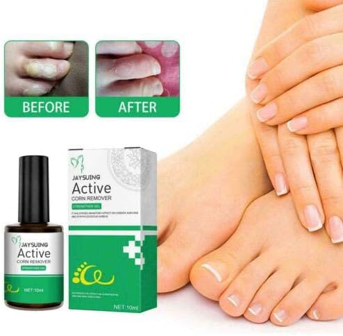 Active Corn Remover Strengthener Gel অ্যাকটিভ কর্ন রিমুভার স্ট্রেংথেনার জেল