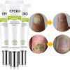 Efero Nail Treatment Repair Gel Efero নেল ট্রিটমেন্ট রিপেয়ার জেল