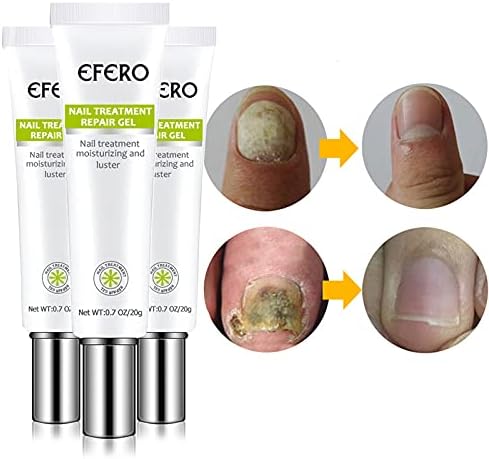 Efero Nail Treatment Repair Gel Efero নেল ট্রিটমেন্ট রিপেয়ার জেল