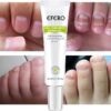 Efero Nail Treatment Repair Gel Efero নেল ট্রিটমেন্ট রিপেয়ার জেল