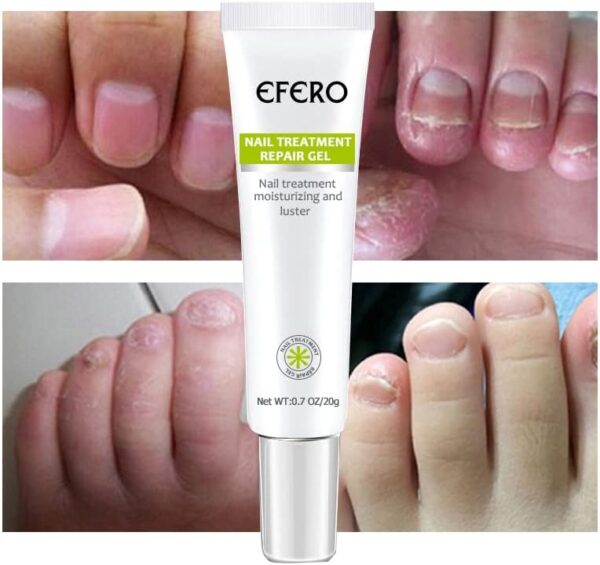 Efero Nail Treatment Repair Gel Efero নেল ট্রিটমেন্ট রিপেয়ার জেল