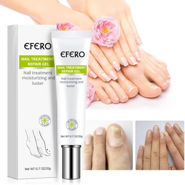 Efero Nail Treatment Repair Gel Efero নেল ট্রিটমেন্ট রিপেয়ার জেল