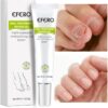 Efero Nail Treatment Repair Gel Efero নেল ট্রিটমেন্ট রিপেয়ার জেল