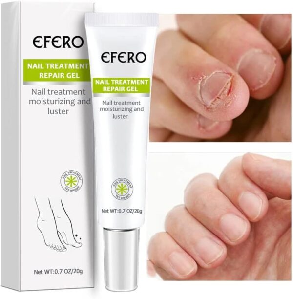 Efero Nail Treatment Repair Gel Efero নেল ট্রিটমেন্ট রিপেয়ার জেল
