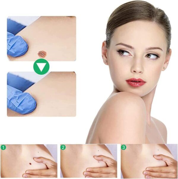 Active Corn Remover Strengthener Gel অ্যাকটিভ কর্ন রিমুভার স্ট্রেংথেনার জেল