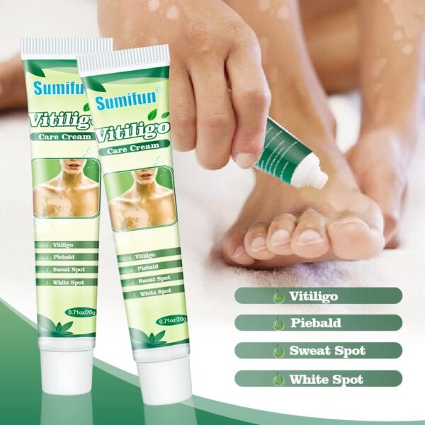 61t9DwBYeIL._AC_SL1000_ Sumifun Vitiligo Cream 20g Sumifun ভিটিলিগো ক্রিম ২০ গ্রাম