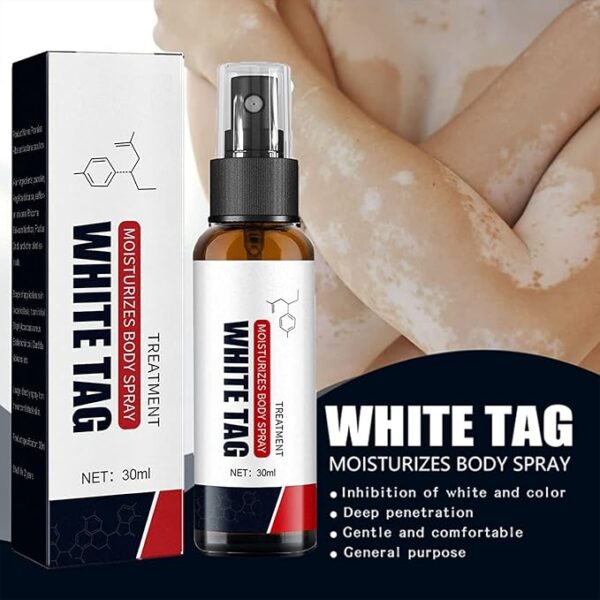 White Tag Cream – Effective Vitiligo Treatment Cream White Tag ক্রিম – ভিটিলিগো চিকিৎসার জন্য কার্যকরী ক্রিম
