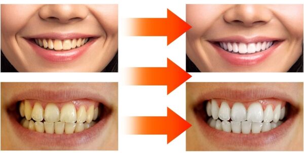 SP-6 Probiotic Bright Whitening Toothpaste  SP-6 প্রোবায়োটিক ব্রাইট হোয়াইটনিং টুথপেস্ট