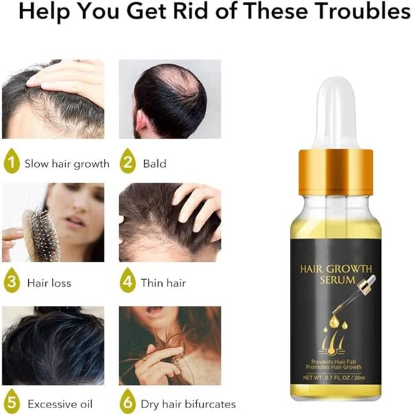 EELHOE Biotin Thickening Herbal Hair Growth Serum | EELHOE বায়োটিন ঘন করার হার্বাল হেয়ার গ্রোথ সিরাম