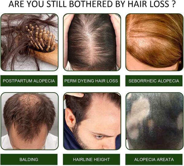 EELHOE Biotin Thickening Herbal Serum5