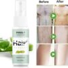 Hair Removal Spray Foam for Women & Men | হেয়ার রিমুভাল স্প্রে ফোম