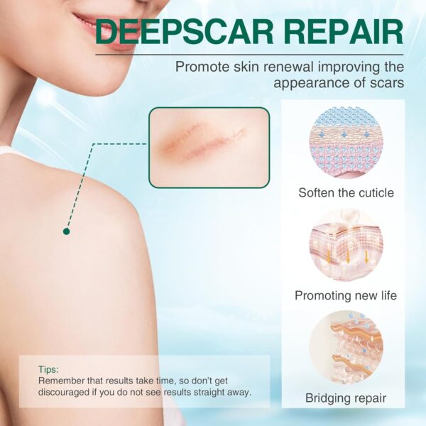 Jaysuing Advanced Scar Repair Gel 20g5