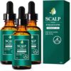 Scalp Folliculitis Therapy Oil Scalp Folliculitis Therapy Oil