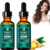 Scalp Folliculitis Therapy Oil2 Scalp Folliculitis Therapy Oil | স্কাল্প ফোলিকুলাইটিস থেরাপি অয়েল