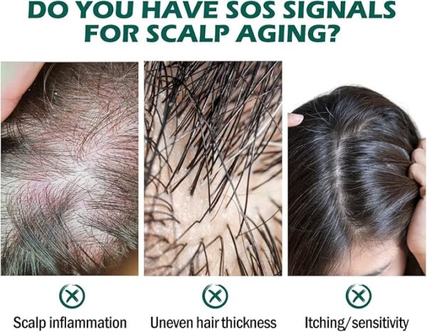 Scalp Folliculitis Therapy Oil4 Scalp Folliculitis Therapy Oil4