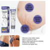 Stretch Mark Cream2 Stretch Mark Cream2