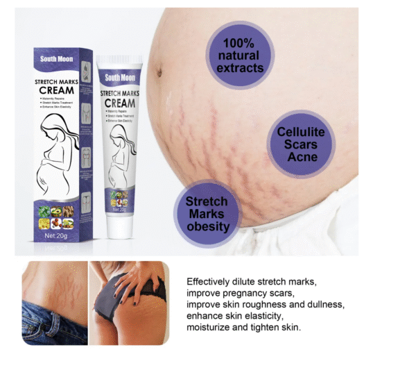 Stretch Mark Cream2 Stretch Mark Cream2