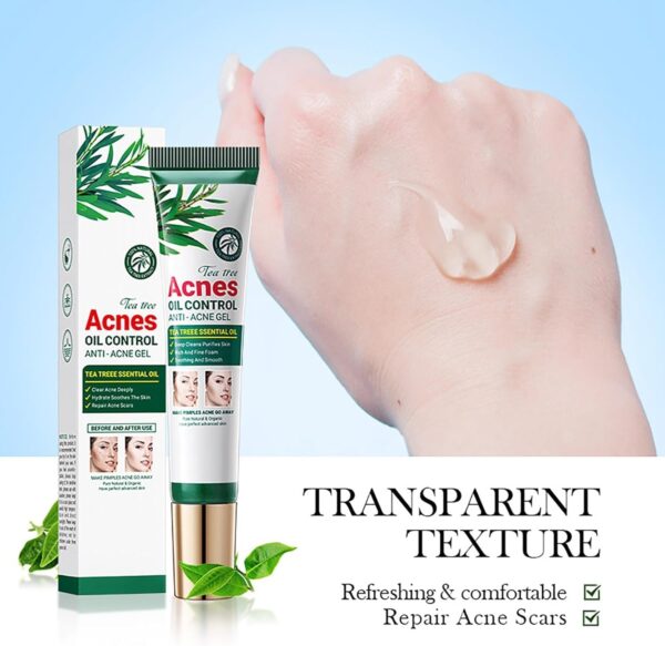 Tea Tree Skin Care Kit Tea Tree Skin Care Kit