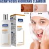 Akanthosis Nigricans Cleanser Akanthosis Nigricans Cleanser