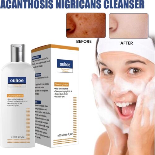 Akanthosis Nigricans Cleanser