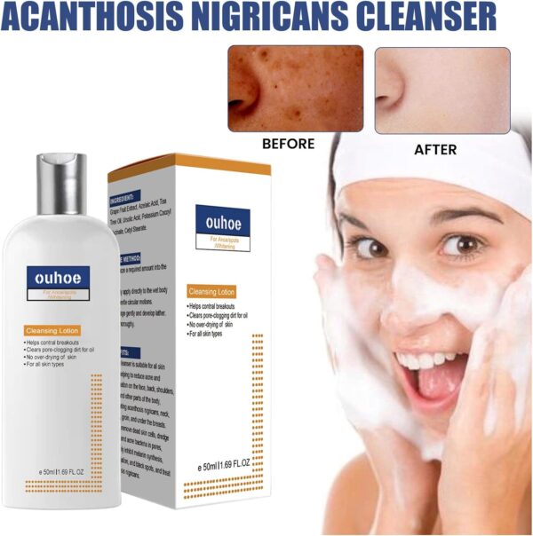 Akanthosis Nigricans Cleanser Akanthosis Nigricans Cleanser