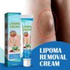 Lipoma Removal Cream