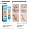 Lipoma Removal Cream3