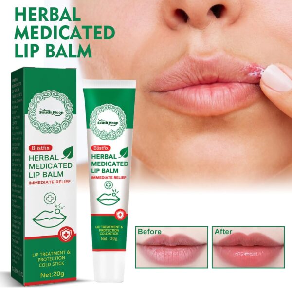 Moisturising Cream for Lips2