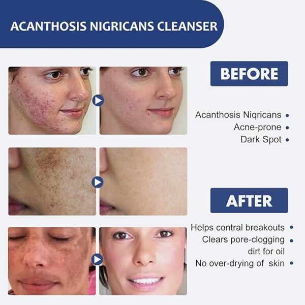 propolis Bee Venom Gel5